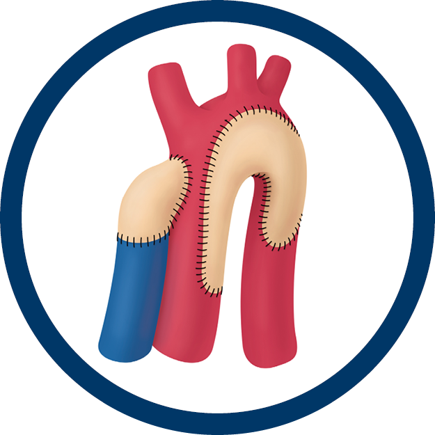 Congenital Defect Repair Patches